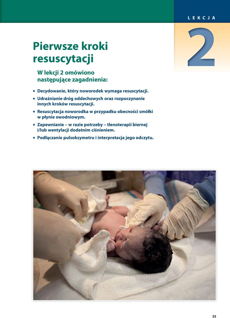 Resuscytacja noworodka w przypadku obecności smółki w płynie owodniowym.