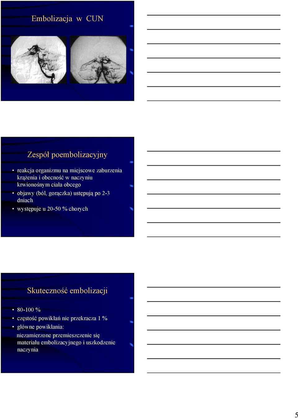 występuje u 20-50 % chorych Skuteczność embolizacji 80-100 % częstość powikłań nie przekracza 1