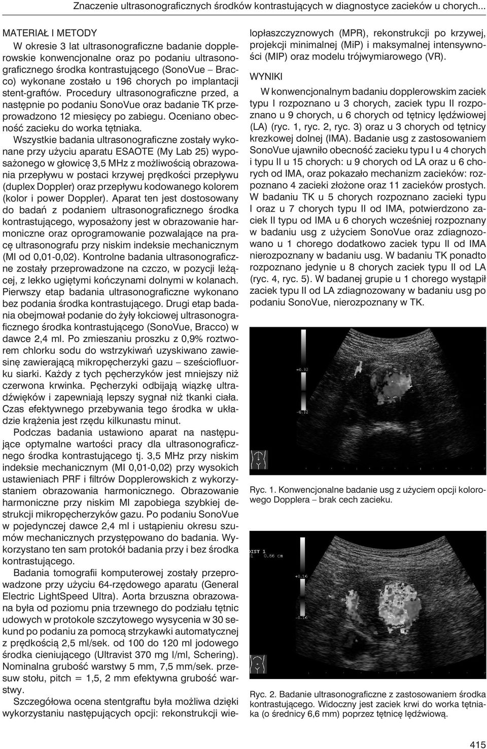 chorych po implantacji stent-graftów. Procedury ultrasonograficzne przed, a następnie po podaniu SonoVue oraz badanie TK przeprowadzono 12 miesięcy po zabiegu.