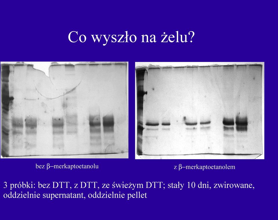 3 próbki: bez DTT, z DTT, ze świeżym DTT;