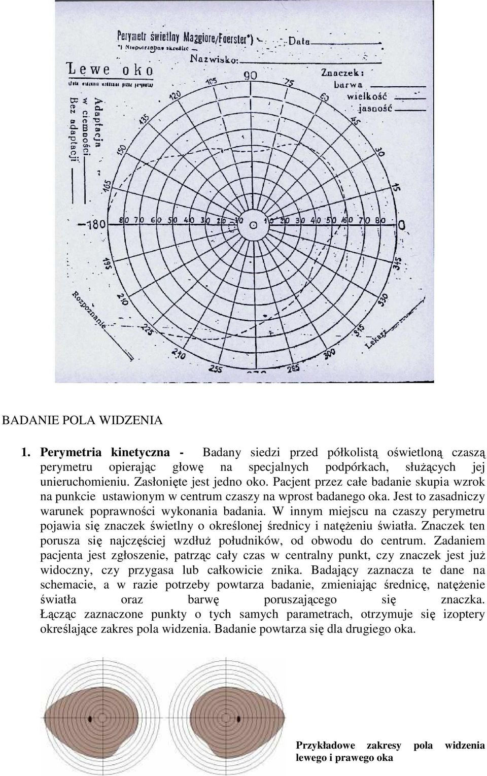 W innym miejscu na czaszy perymetru pojawia się znaczek świetlny o określonej średnicy i natężeniu światła. Znaczek ten porusza się najczęściej wzdłuż południków, od obwodu do centrum.