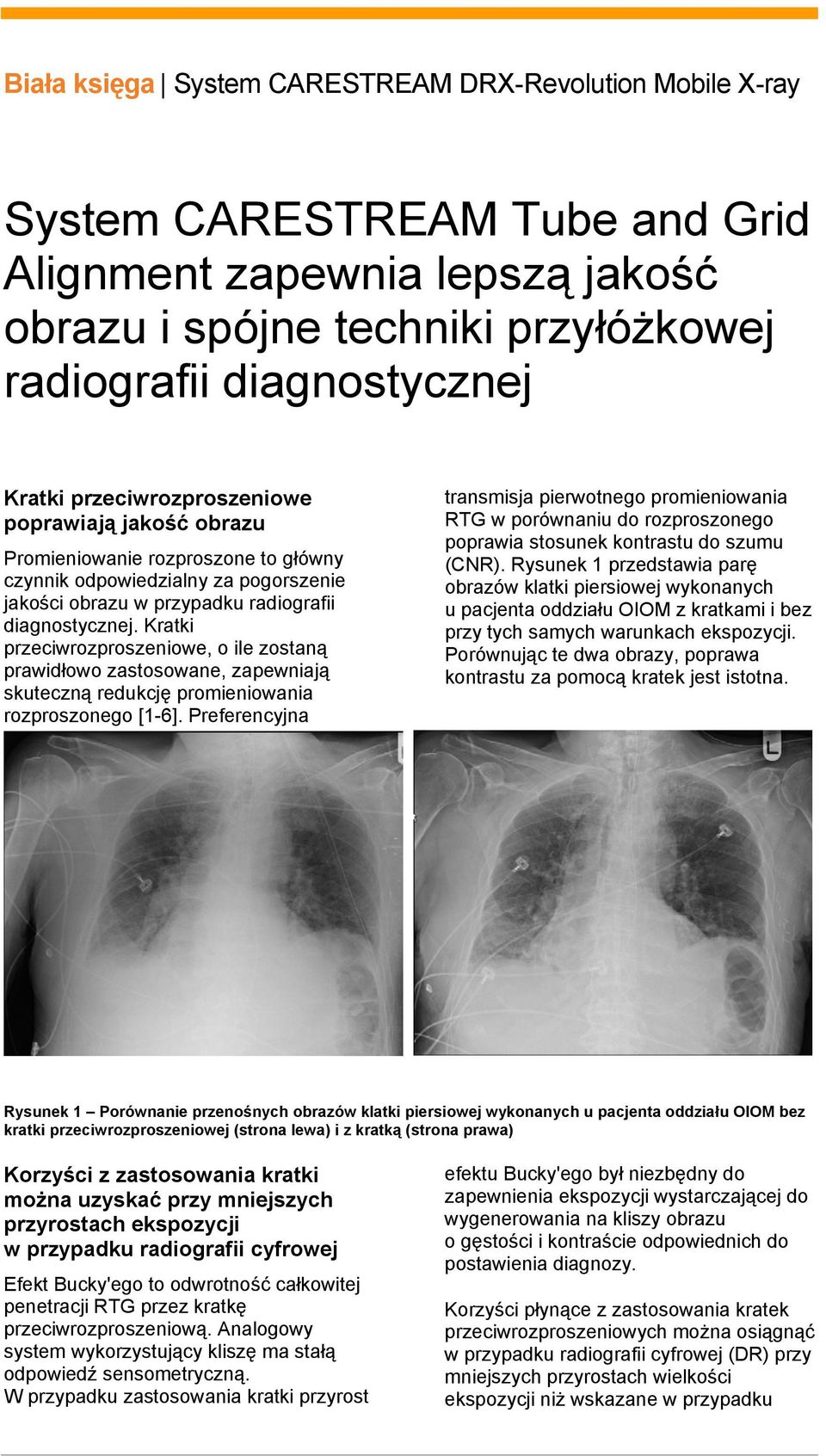 Kratki przeciwrozproszeniowe, o ile zostaną prawidłowo zastosowane, zapewniają skuteczną redukcję promieniowania rozproszonego [1-6].