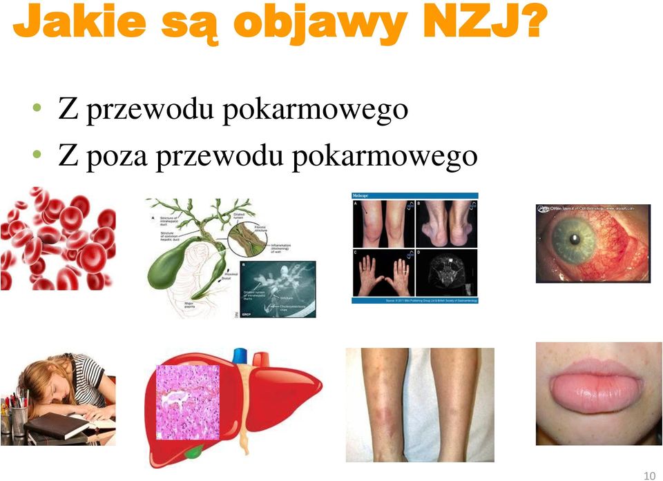 pokarmowego Z poza