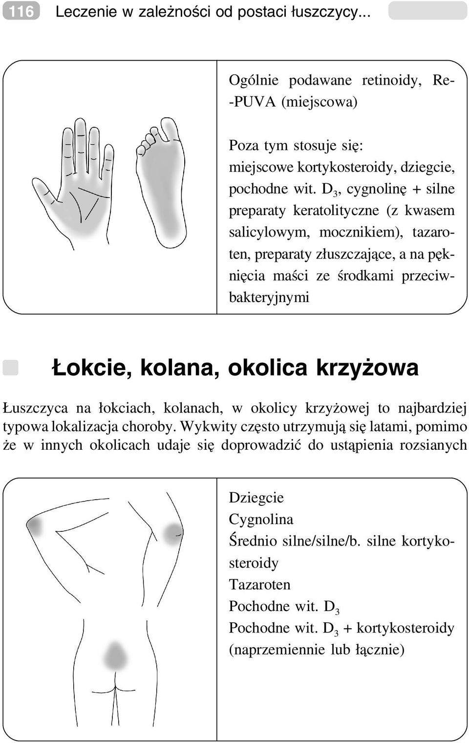 kolana, okolica krzyżowa Łuszczyca na łokciach, kolanach, w okolicy krzyżowej to najbardziej typowa lokalizacja choroby.