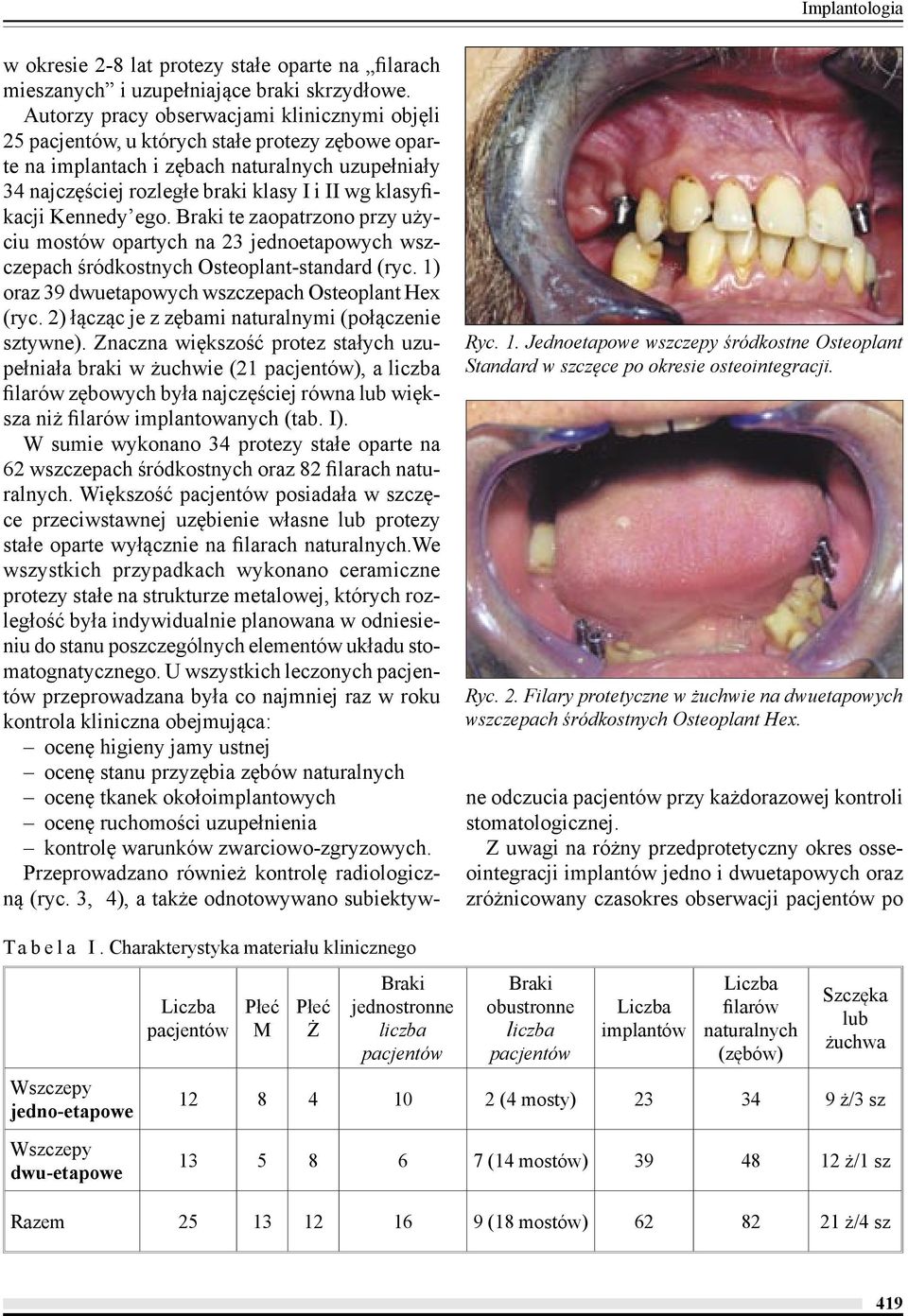 Autorzy pracy obserwacjami klinicznymi objęli 25 pacjentów, u których stałe protezy zębowe oparte na implantach i zębach naturalnych uzupełniały 34 najczęściej rozległe braki klasy I i II wg