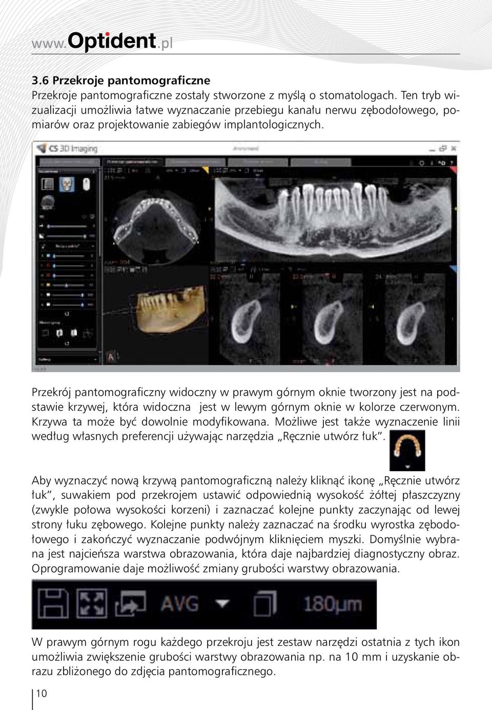 Przekrój pantomograficzny widoczny w prawym górnym oknie tworzony jest na podstawie krzywej, która widoczna jest w lewym górnym oknie w kolorze czerwonym. Krzywa ta może być dowolnie modyfikowana.