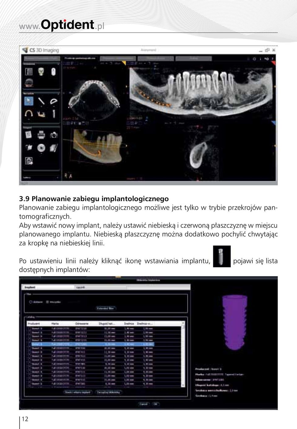 Aby wstawić nowy implant, należy ustawić niebieską i czerwoną płaszczyznę w miejscu planowanego implantu.
