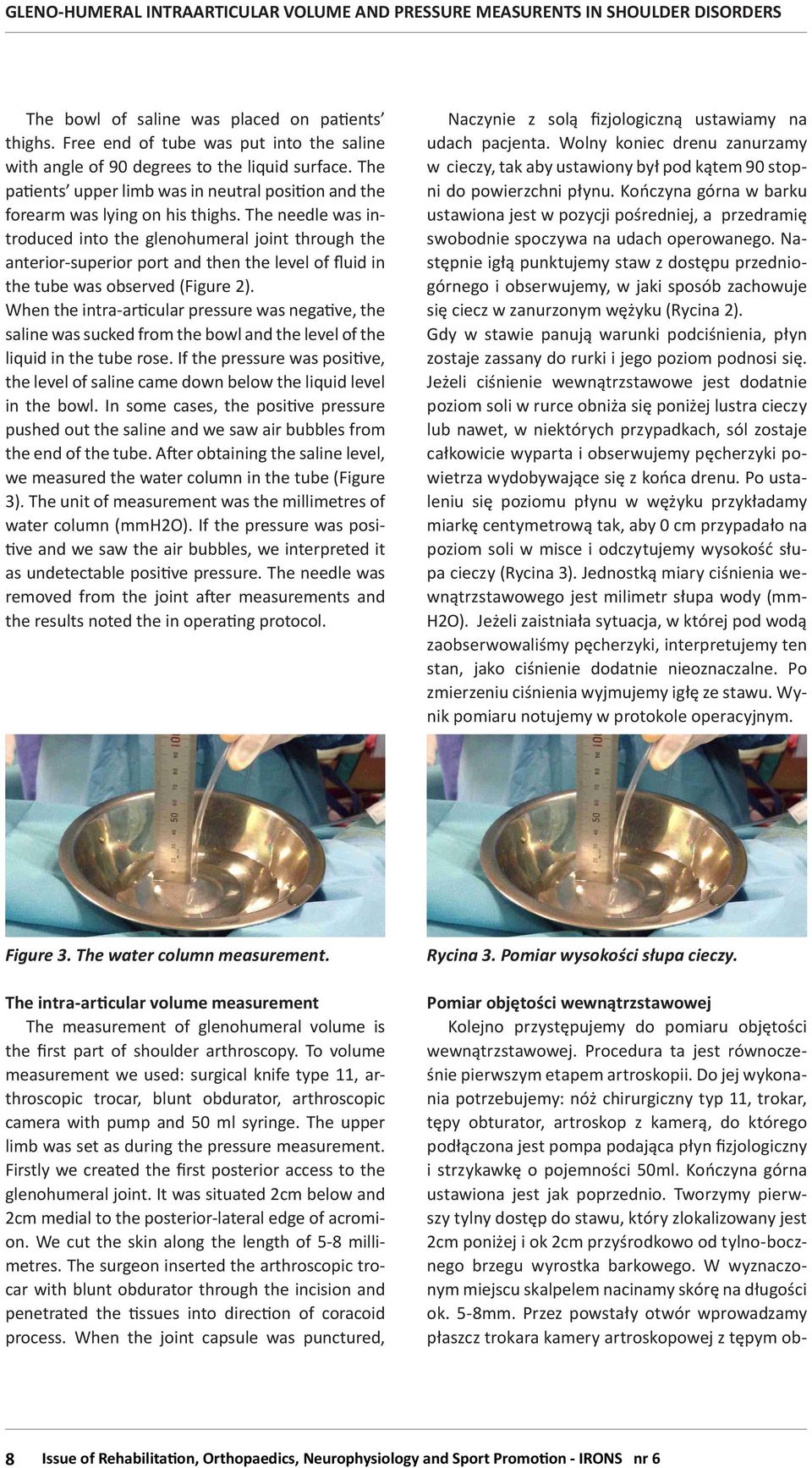 The needle was introduced into the glenohumeral joint through the anterior-superior port and then the level of fluid in the tube was observed (Figure 2).