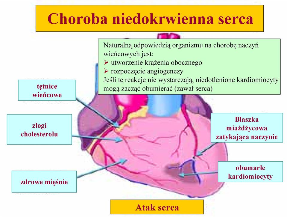 reakcje nie wystarczają, niedotlenione kardiomiocyty mogą zacząć obumierać (zawał serca)