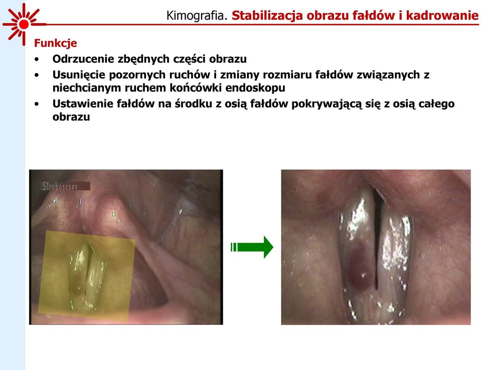 zmiany rozmiaru fałdów związanych z niechcianym ruchem końcówki