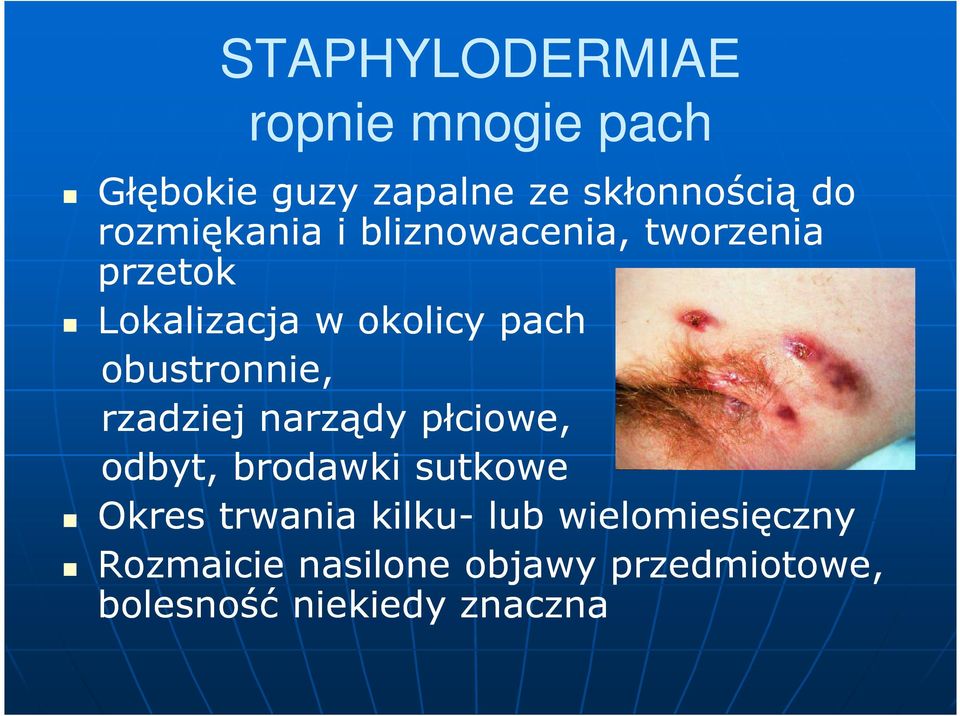 obustronnie, rzadziej narządy płciowe, odbyt, brodawki sutkowe Okres trwania