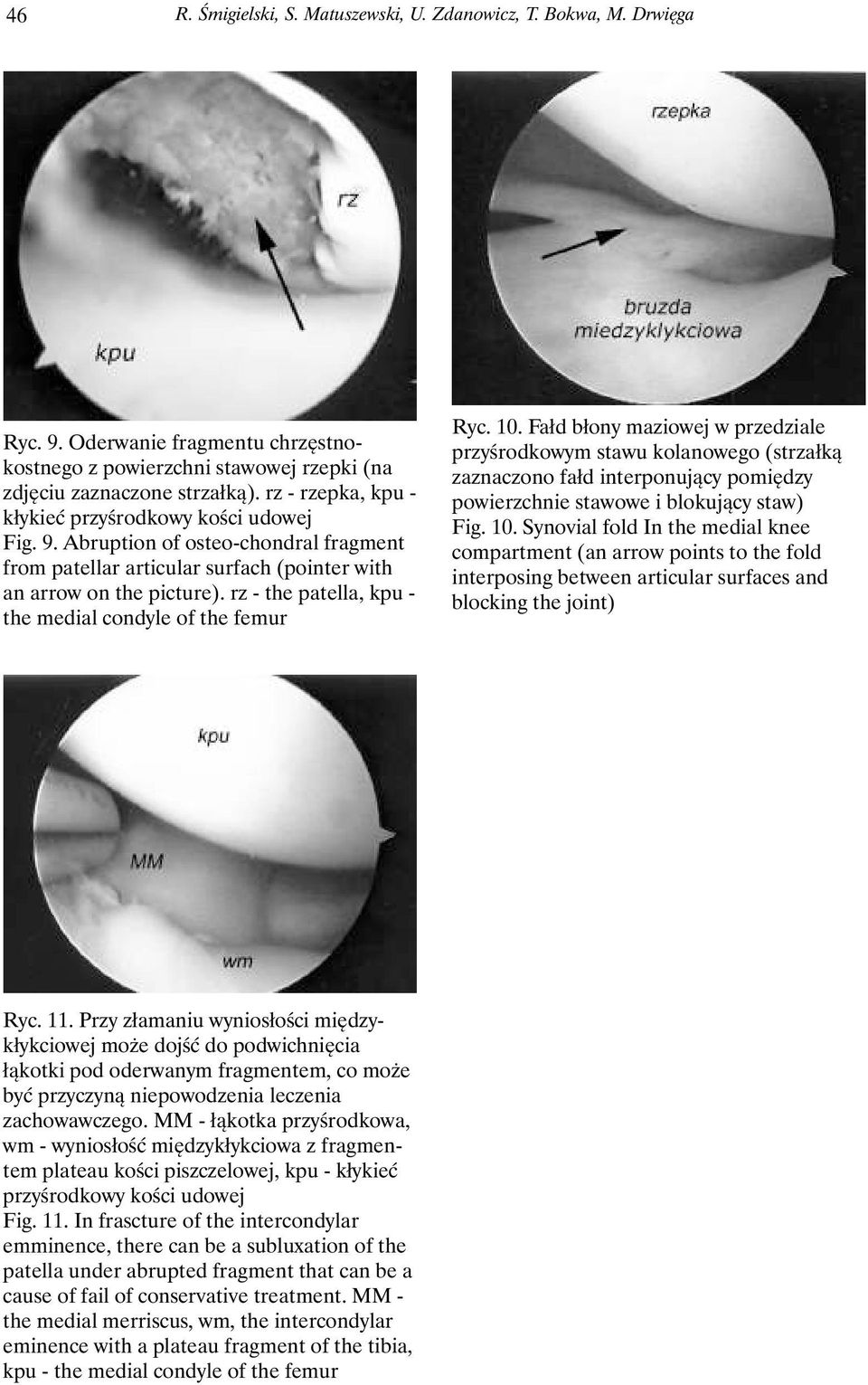 rz - the patella, kpu - the medial condyle of the femur Ryc. 10.