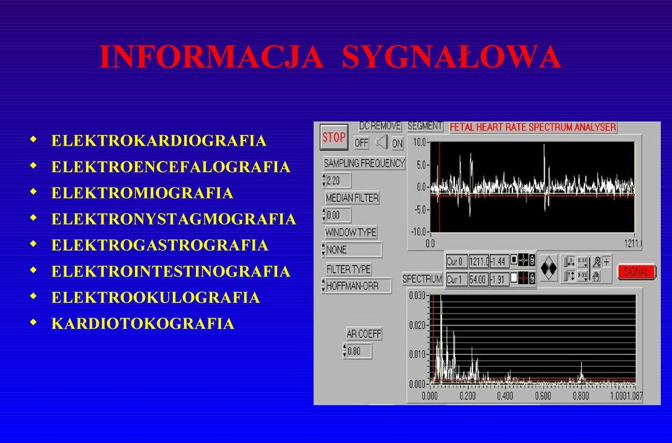 ELEKTRONYSTAGMOGRAFIA ELEKTROGASTROGRAFIA