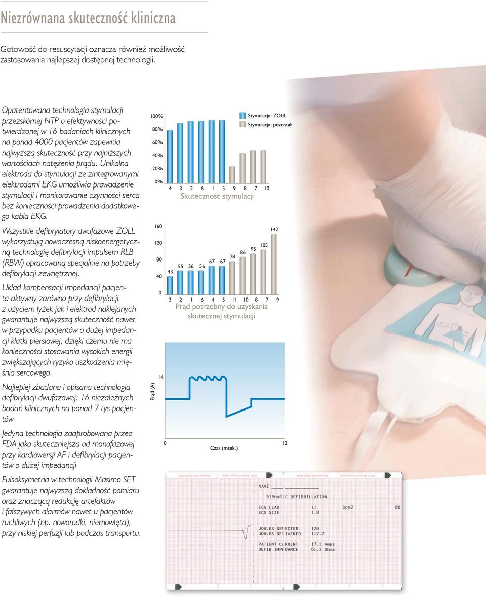 natężenia prądu. Unikalna elektroda do stymulacji ze zintegrowanymi elektrodami EKG umożliwia prowadzenie stymulacji i monitorowanie czynności serca bez konieczności prowadzenia dodatkowego kabla EKG.