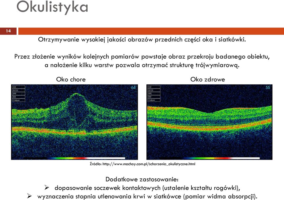 Okulistyka 14 Otrzymywanie wysokiej jakości obrazów przednich części oka i siatkówki.