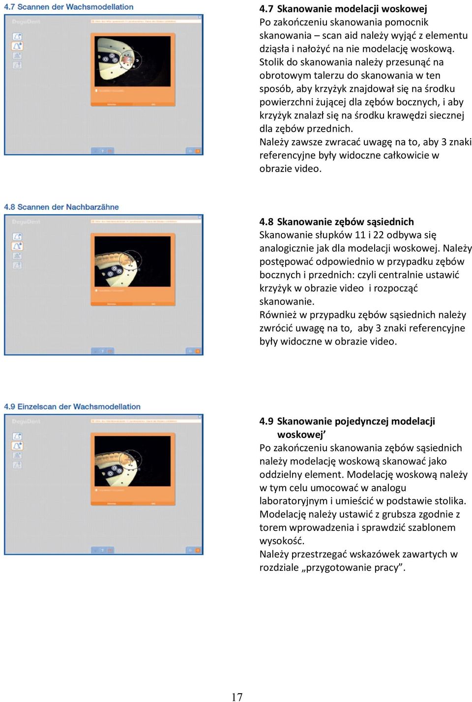 siecznej dla zębów przednich. Należy zawsze zwracać uwagę na t, aby 3 znaki referencyjne były widczne całkwicie w brazie vide. 4.
