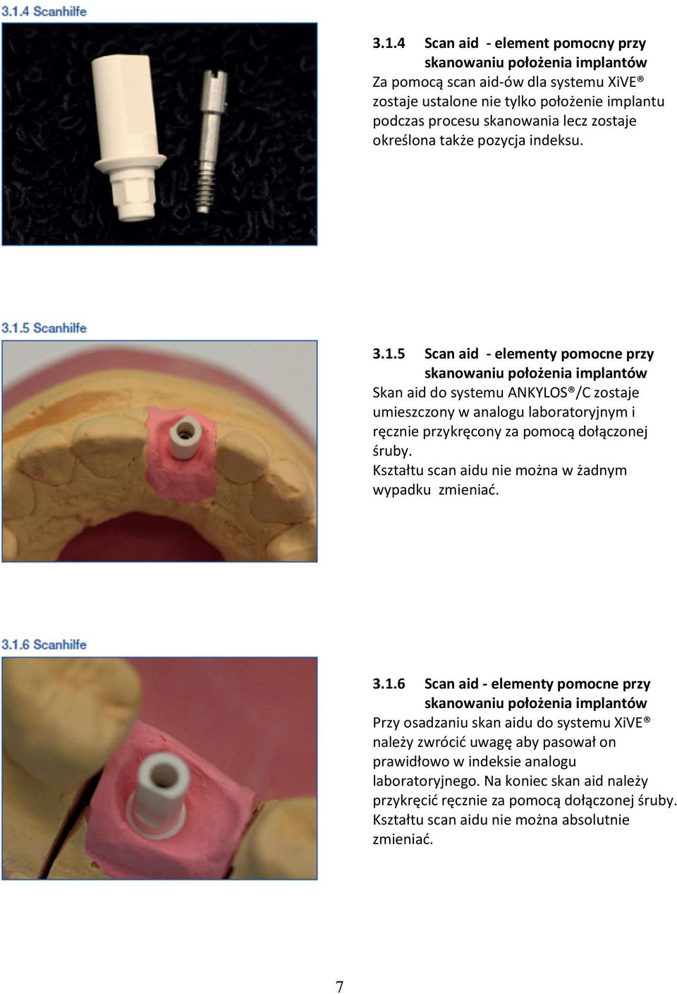 5 Scan aid - elementy pmcne przy skanwaniu płżenia implantów Skan aid d systemu ANKYLOS /C zstaje umieszczny w analgu labratryjnym i ręcznie przykręcny za pmcą dłącznej śruby.