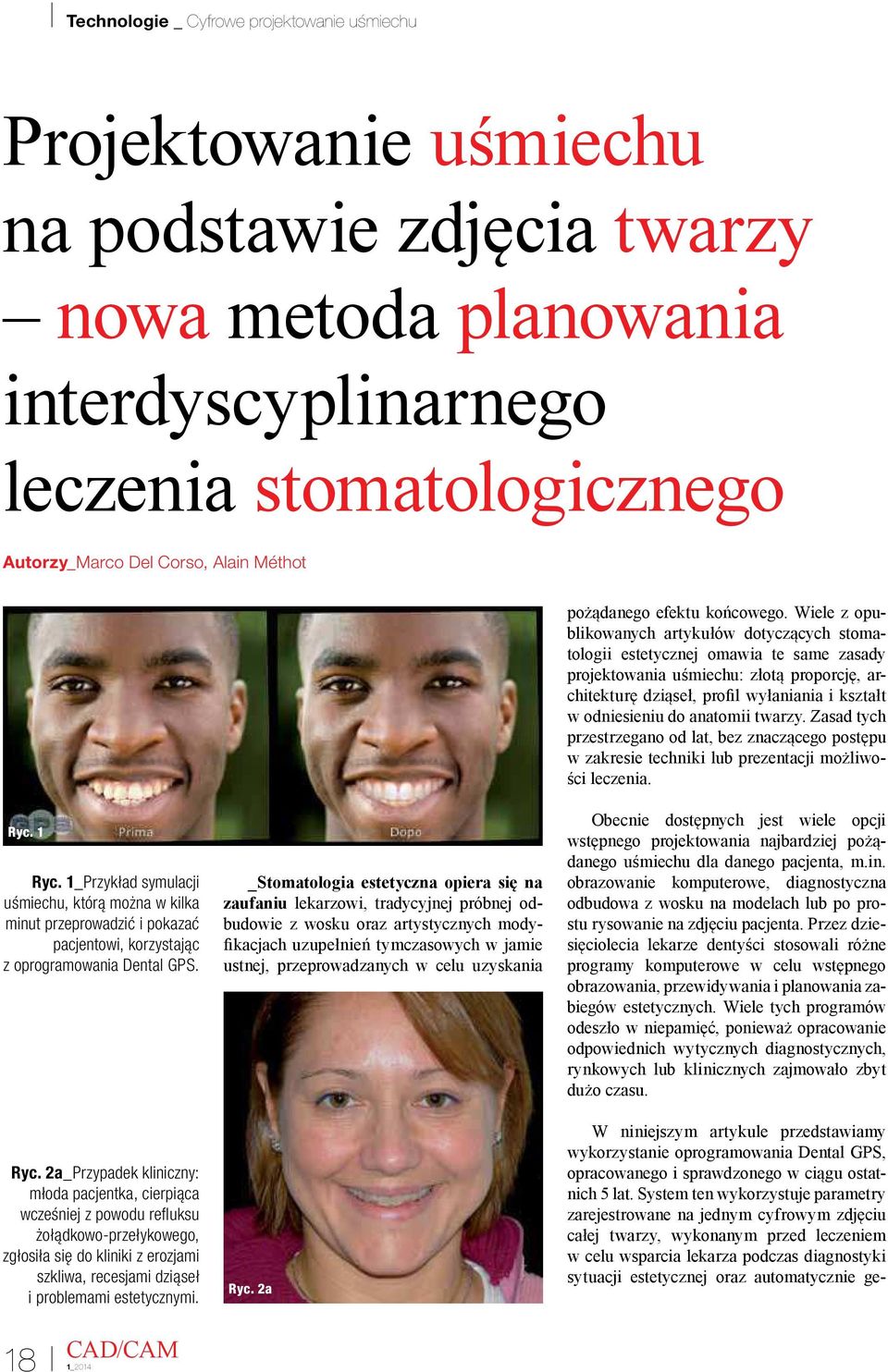 anatomii twarzy. Zasad tych przestrzegano od lat, bez znaczącego postępu w zakresie techniki lub prezentacji możliwości leczenia. Ryc. 1 Ryc.