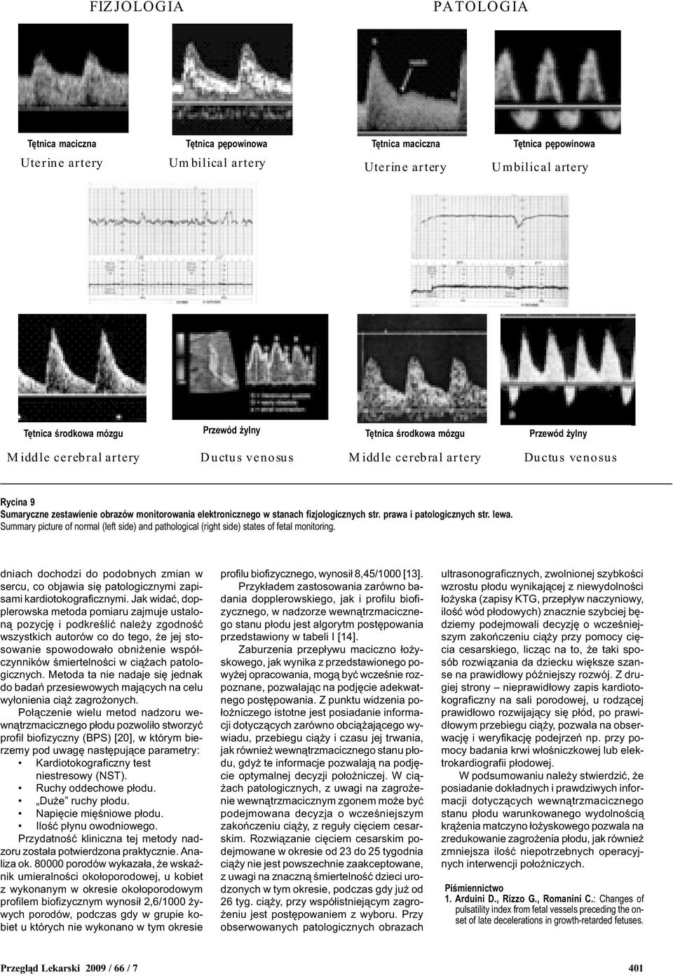 mózgu Middle cerebral artery Przewód ylny Ductus venosus Rycina 9 Sumaryczne zestawienie obrazów monitorowania elektronicznego w stanach fizjologicznych str. prawa i patologicznych str. lewa.
