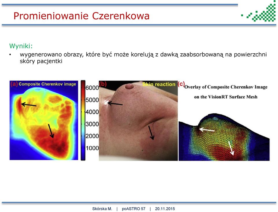 które być może korelują z dawką