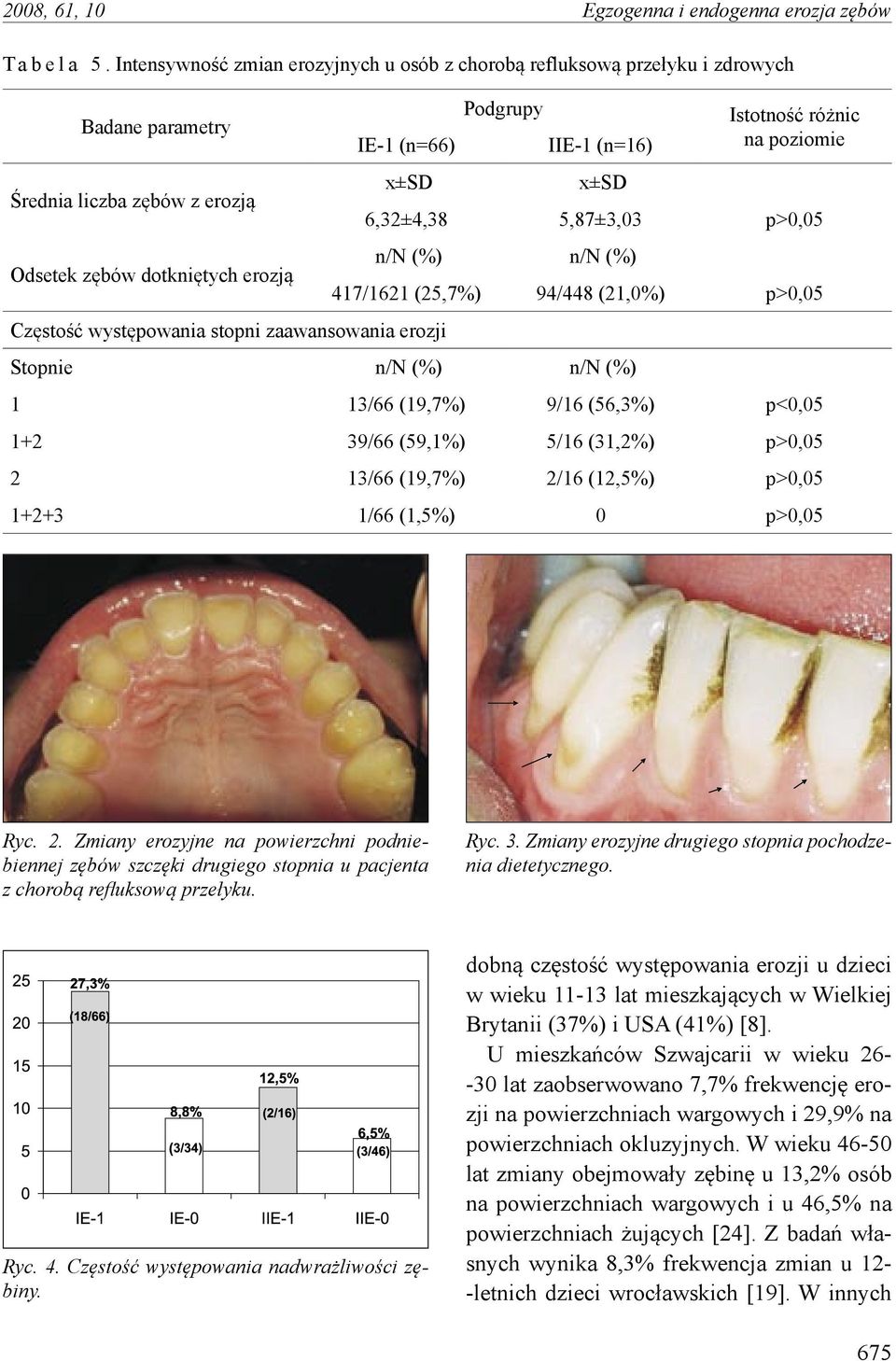 zaawansowania erozji Podgrupy IIE-1 (n=16) x±sd x±sd Istotność różnic na poziomie 6,32±4,38 5,87±3,03 p>0,05 n/n (%) n/n (%) 417/1621 (25,7%) 94/448 (21,0%) p>0,05 Stopnie n/n (%) n/n (%) 1 13/66