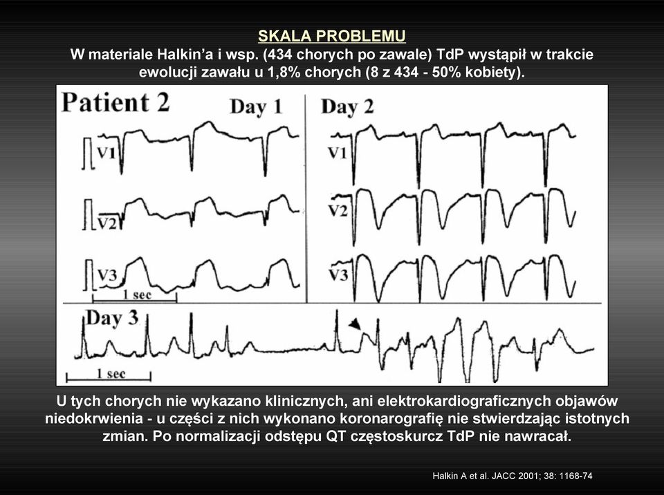 U tych chorych nie wykazano klinicznych, ani elektrokardiograficznych objawów niedokrwienia - u