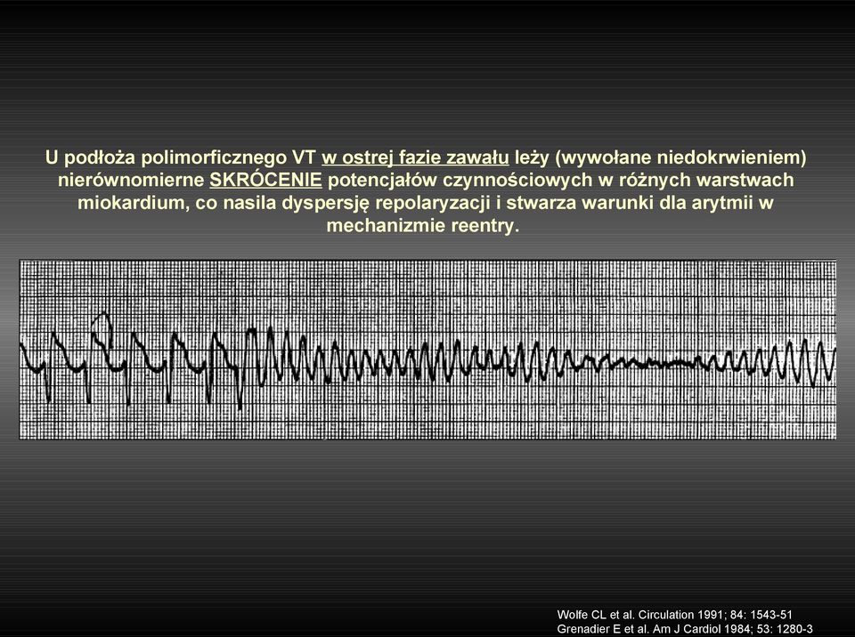 nasila dyspersję repolaryzacji i stwarza warunki dla arytmii w mechanizmie reentry.