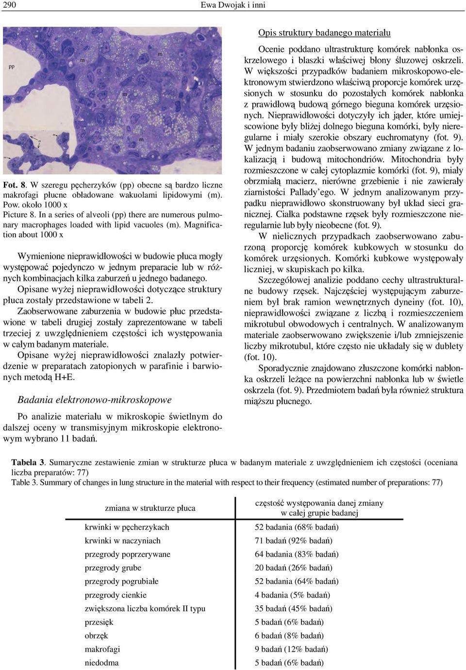 Magnification about 1000 x Wymienione nieprawidłowości w budowie płuca mogły występować pojedynczo w jednym preparacie lub w różnych kombinacjach kilka zaburzeń u jednego badanego.