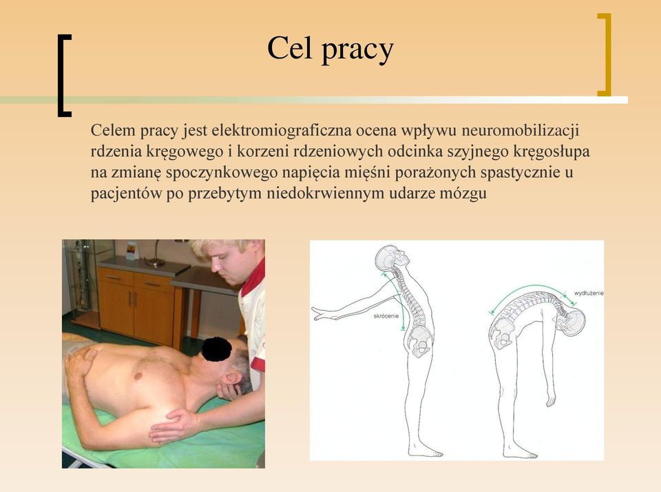 szyjnego kręgosłupa na zmianę spoczynkowego napięcia mięśni