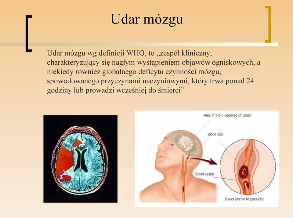 niekiedy również globalnego deficytu czynności mózgu, spowodowanego