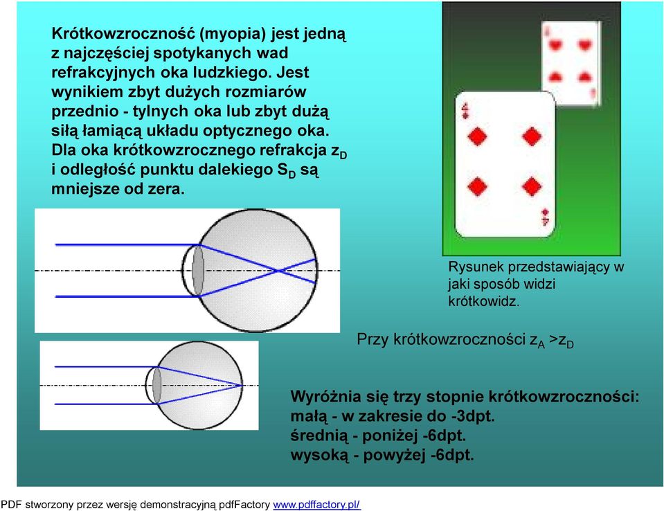 Dla oka krótkowzrocznego refrakcja z D i odległość punktu dalekiego S D są mniejsze od zera.