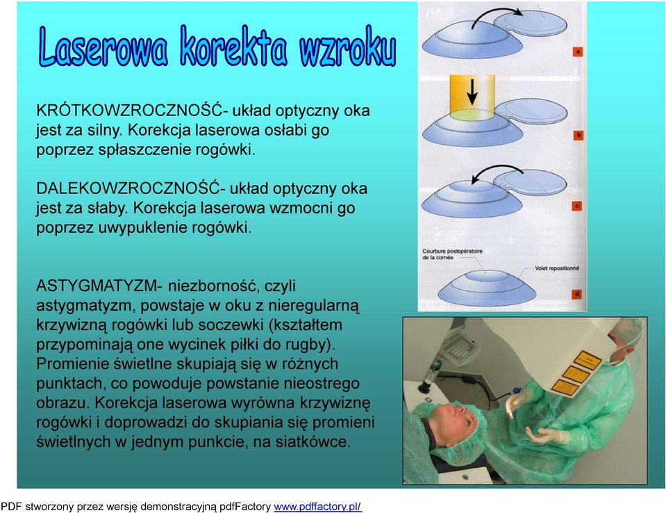 ASTYGMATYZM- niezborność, czyli astygmatyzm, powstaje w oku z nieregularną krzywizną rogówki lub soczewki (kształtem przypominają one wycinek piłki