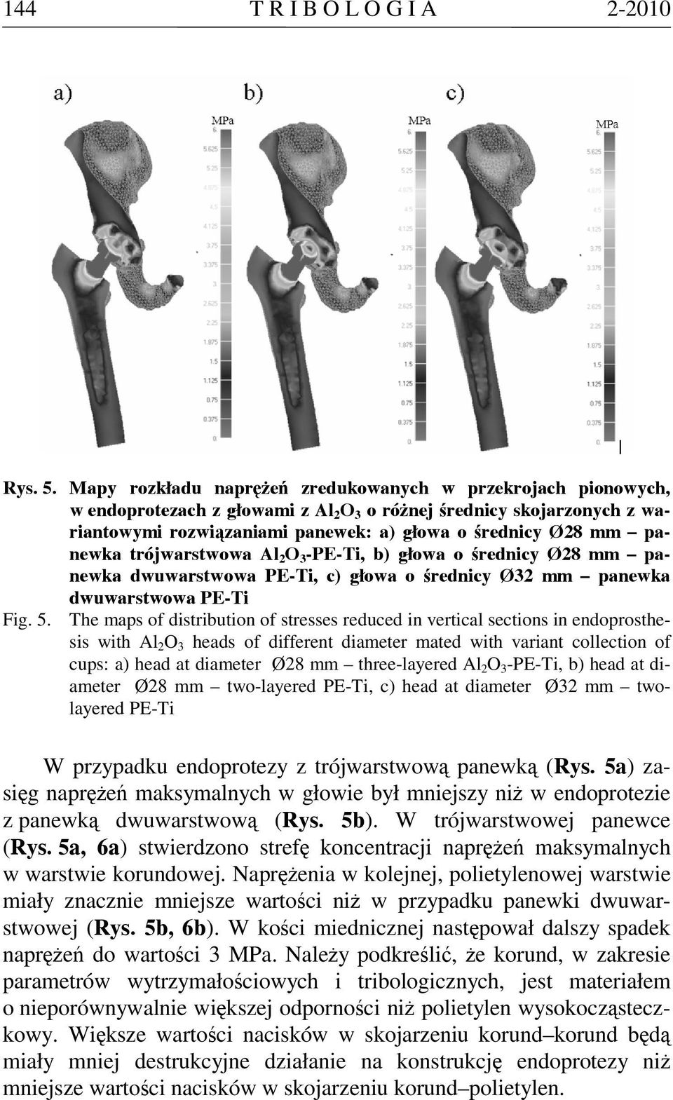 panewka trójwarstwowa Al 2 O 3 -PE-Ti, b) głowa o średnicy Ø28 mm panewka dwuwarstwowa PE-Ti, c) głowa o średnicy Ø32 mm panewka dwuwarstwowa PE-Ti Fig. 5.