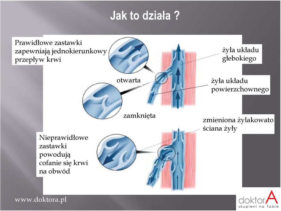 żyła y układu głebokiego otwarta żyła układu powierzchownego