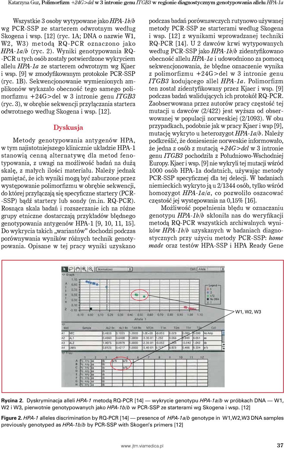 Wyniki genotypowania RQ- -PCR u tych osób zostały potwierdzone wykryciem allelu HPA-1a ze starterem odwrotnym wg Kjaer i wsp. [9] w zmodyfikowanym protokole PCR-SSP (ryc. 1B).
