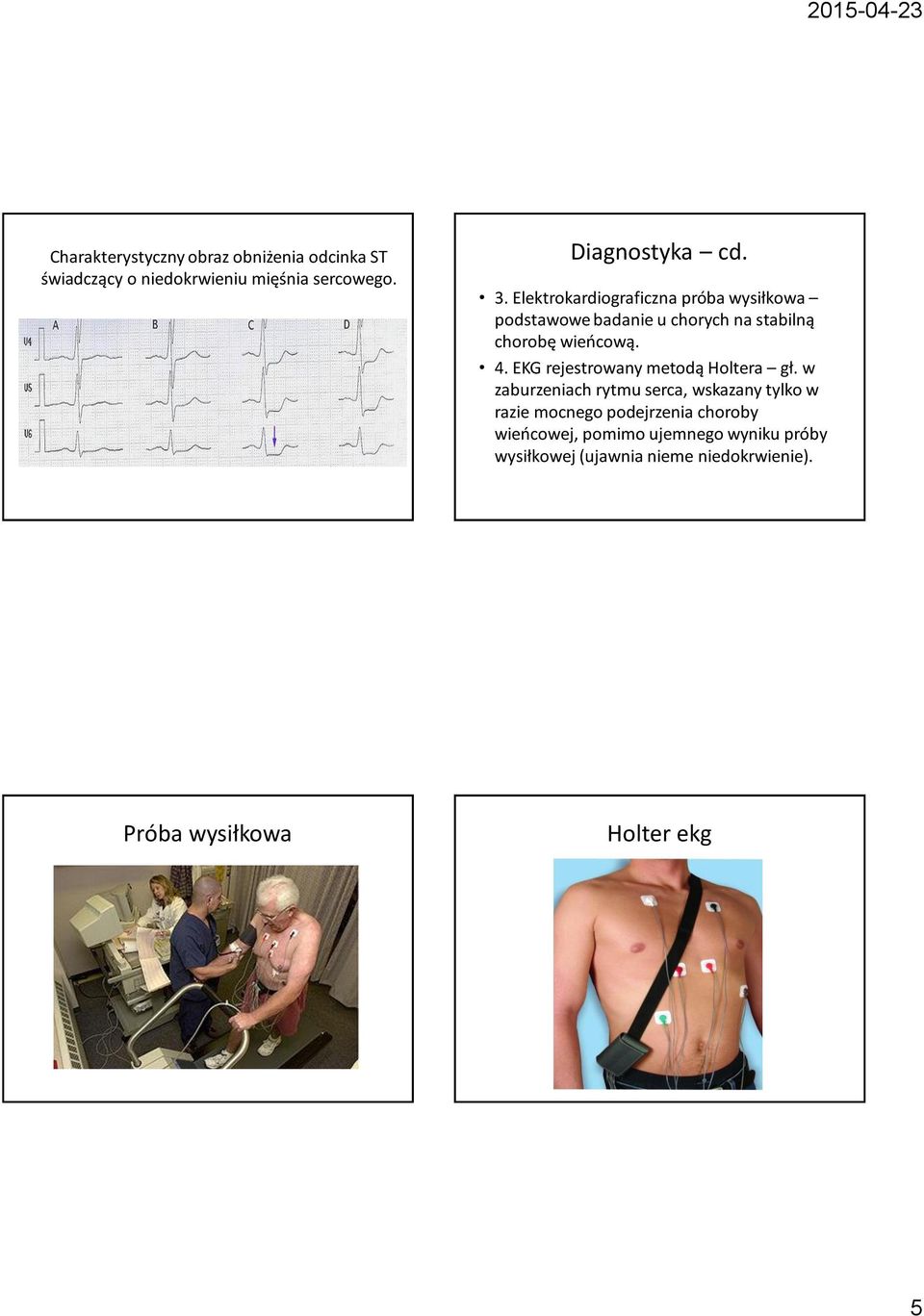 EKG rejestrowany metodą Holtera gł.