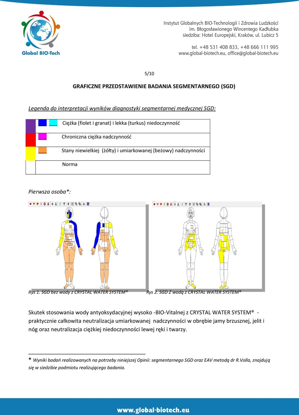 SGD Z wodą z CRYSTAL WATER SYSTEM Skutek stosowania wody antyoksydacyjnej wysoko -BIO-Vitalnej z CRYSTAL WATER SYSTEM - praktycznie całkowita neutralizacja umiarkowanej nadczynności w obrębie jamy