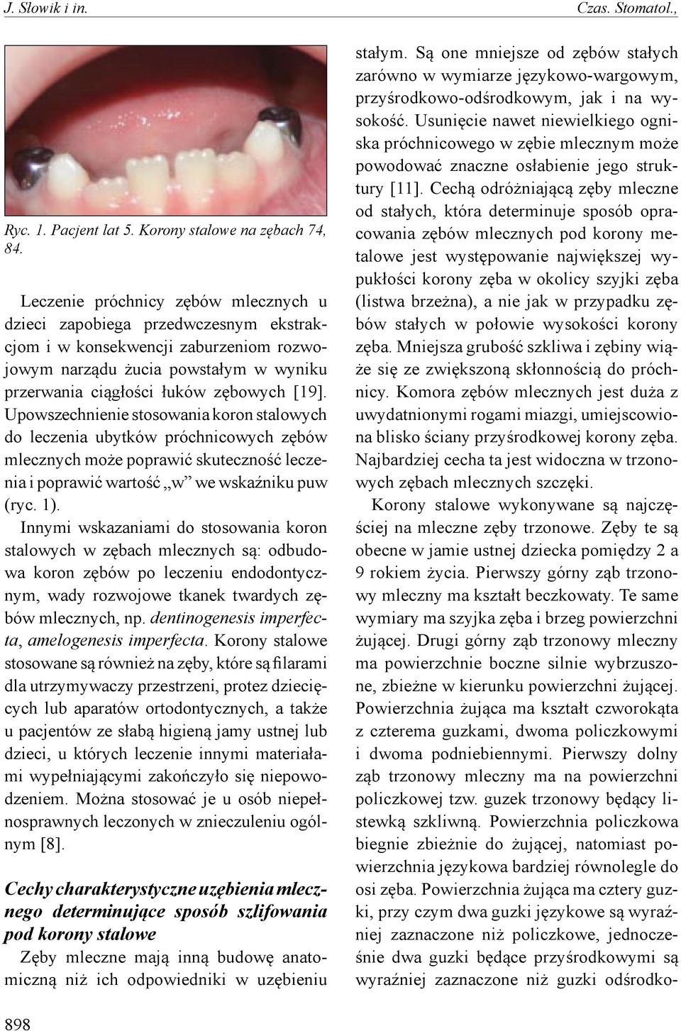 Upowszechnienie stosowania koron stalowych do leczenia ubytków próchnicowych zębów mlecznych może poprawić skuteczność leczenia i poprawić wartość w we wskaźniku puw (ryc. 1).