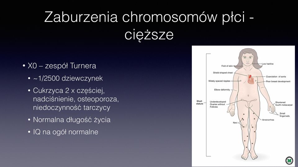 częściej, nadciśnienie, osteoporoza,