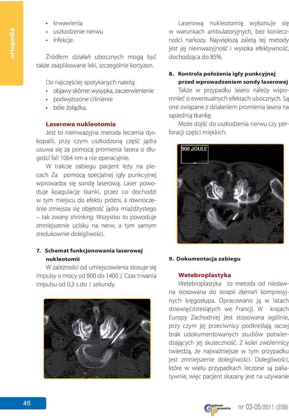 Laserowa nukleotomia Jest to nieinwazyjna metoda leczenia dyskopatii, przy czym uszkodzoną część jądra usuwa się za pomocą promienia lasera o długości fali 1064 nm a nie operacyjnie.