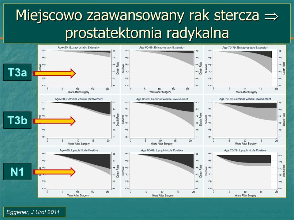 prostatektomia