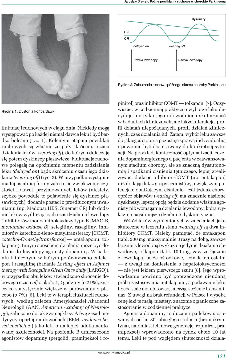 Kolejnym etapem powikłań ruchowych są właśnie zespoły skrócenia czasu działania leków (wearing off), do których dołączają się potem dyskinezy pląsawicze.