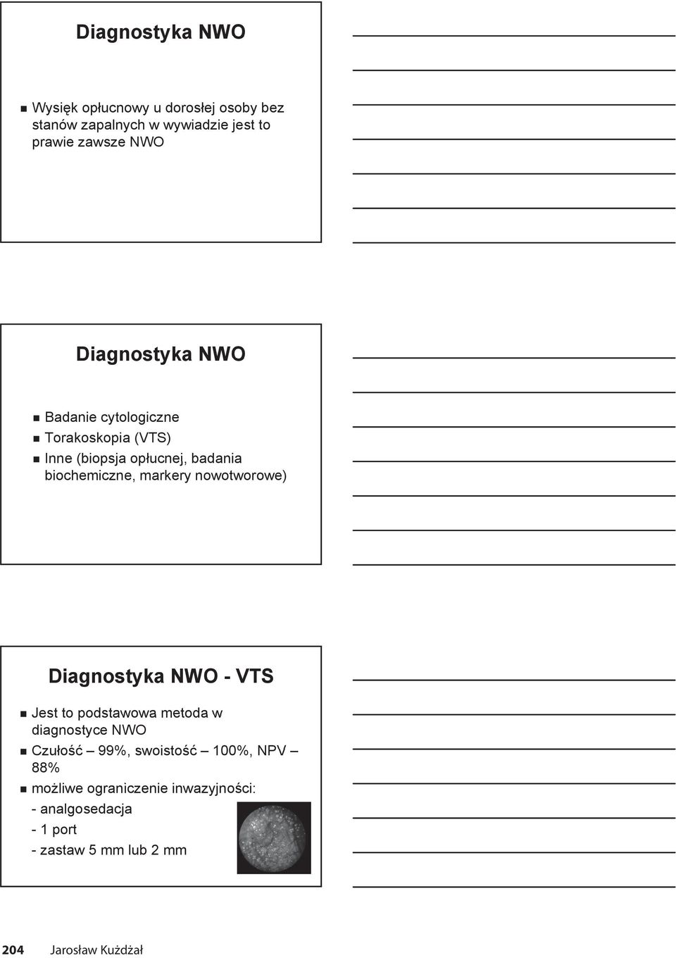 nowotworowe) Diagnostyka NWO - VTS Jest to podstawowa metoda w diagnostyce NWO Czułość 99%, swoistość 100%,