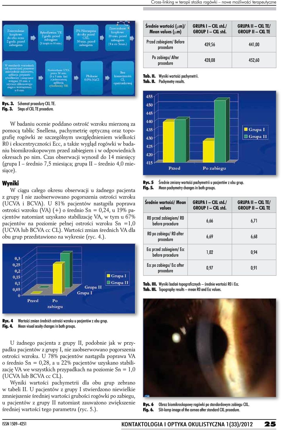 Fig. 3. Schemat procedury CXL TE. Steps of CXL TE.