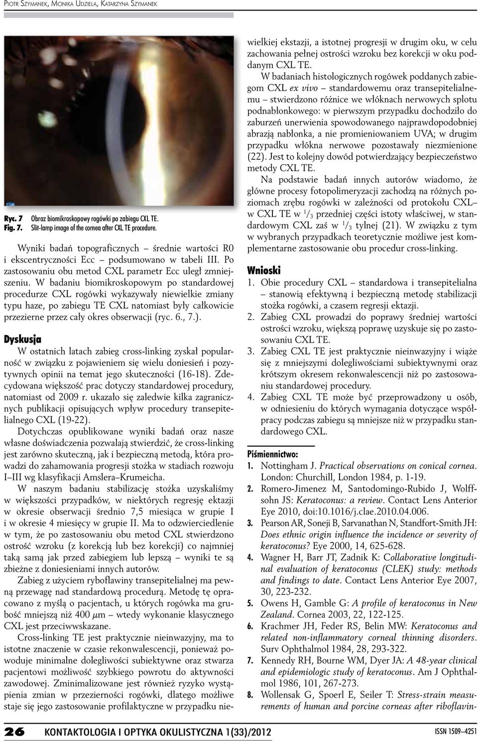 W badaniu biomikroskopowym po standardowej procedurze CXL rogówki wykazywały niewielkie zmiany typu haze, po zabiegu TE CXL natomiast były całkowicie przezierne przez cały okres obserwacji (ryc. 6.