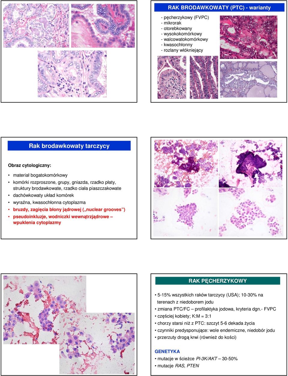 cytoplazma bruzdy, zagięcia błony jądrowej ( nuclear grooves ) pseudoinkluzje, wodniczki wewnątrzjądrowe wpuklenia cytoplazmy RAK PĘCHERZYKOWY 5-15% wszystkich raków tarczycy (USA); 10-30% na