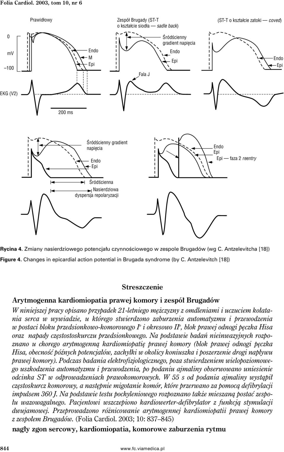 napiêcia faza2reentry Œródœcienna Nasierdziowa dyspersja repolaryzacji Rycina 4. Zmiany nasierdziowego potencjału czynnościowego w zespole Brugadów (wg C. Antzelevitcha [18]) Figure 4.