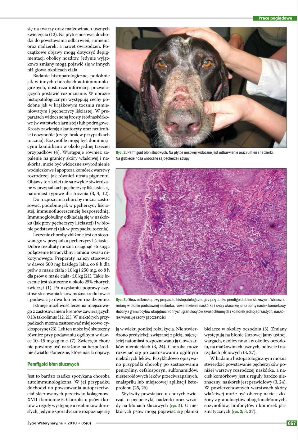 Badanie histopatologiczne, podobnie jak w innych chorobach autoimmunologicznych, dostarcza informacji pozwalających postawić rozpoznanie.