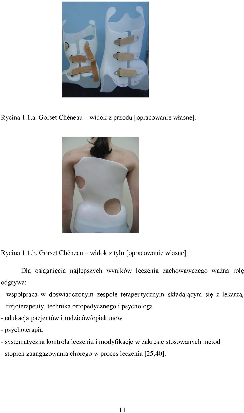 składającym się z lekarza, fizjoterapeuty, technika ortopedycznego i psychologa - edukacja pacjentów i rodziców/opiekunów -