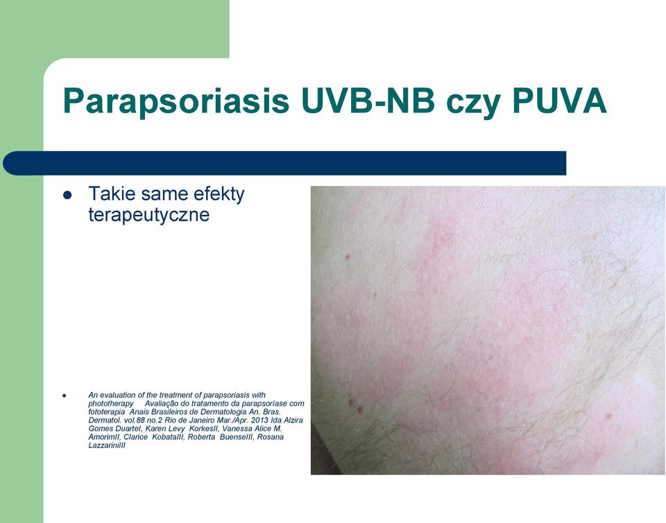 Brasileiros de Dermatologia An. Bras. Dermatol. vol.88 no.2 Rio de Janeiro Mar./Apr.